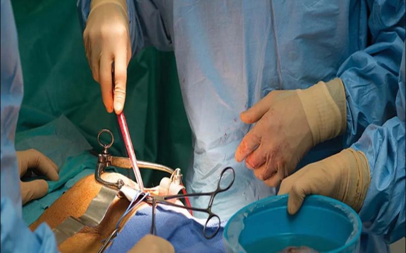 उत्तर प्रदेश का रहने वाला है किडनी रैकेट का मास्टरमाइंड