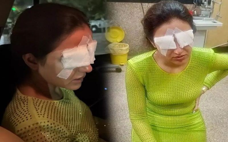 कॉर्निया डैमेज के बाद छलका जैस्मिन भसीन का दर्द, बोली मुझे...