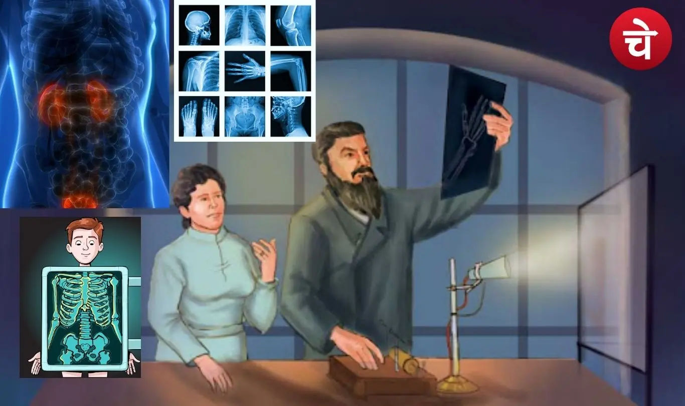 X-ray history