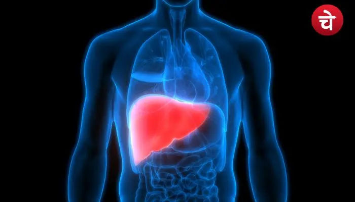 Fatty Liver Diet Tips