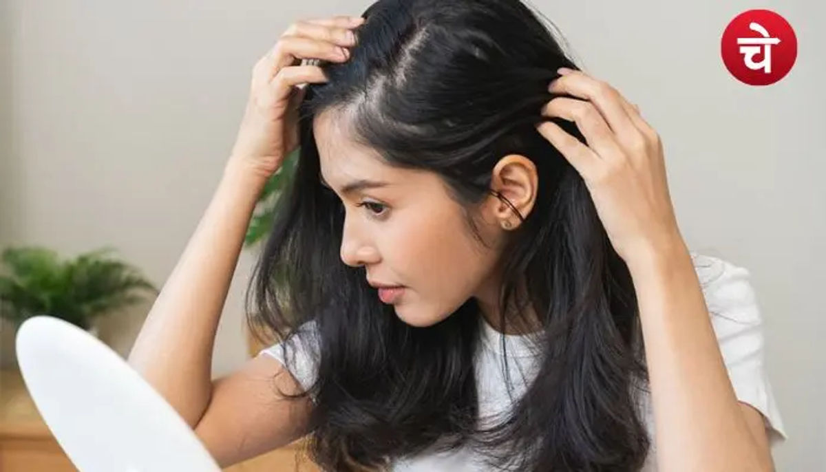 इस देसी स्कैल्प पैक से 2 हफ्ते में Good Bye कहेगा डैंड्रफ, बाल दिखेंगे खूबसूरत