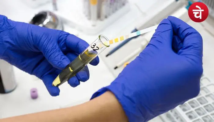 Urine Test