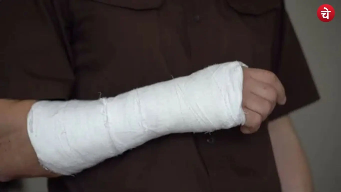 plaster