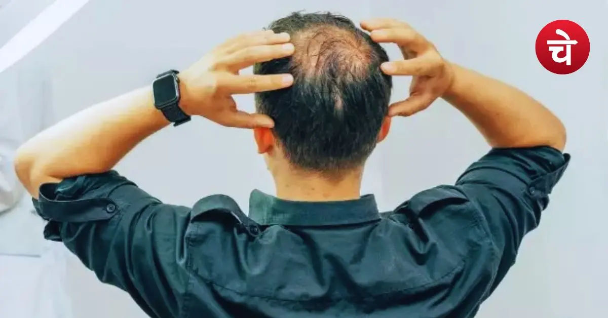 गंजेपन से हैं परेशान? इन 7 आसान ट्रिक्स से मिनटों में मिलेगा फायदा!