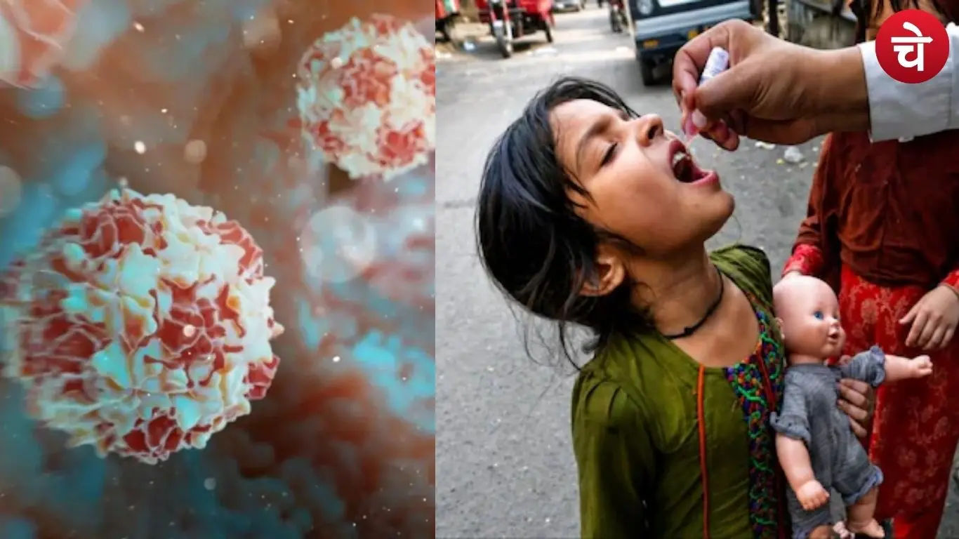 Ghaziabad Polio Virus