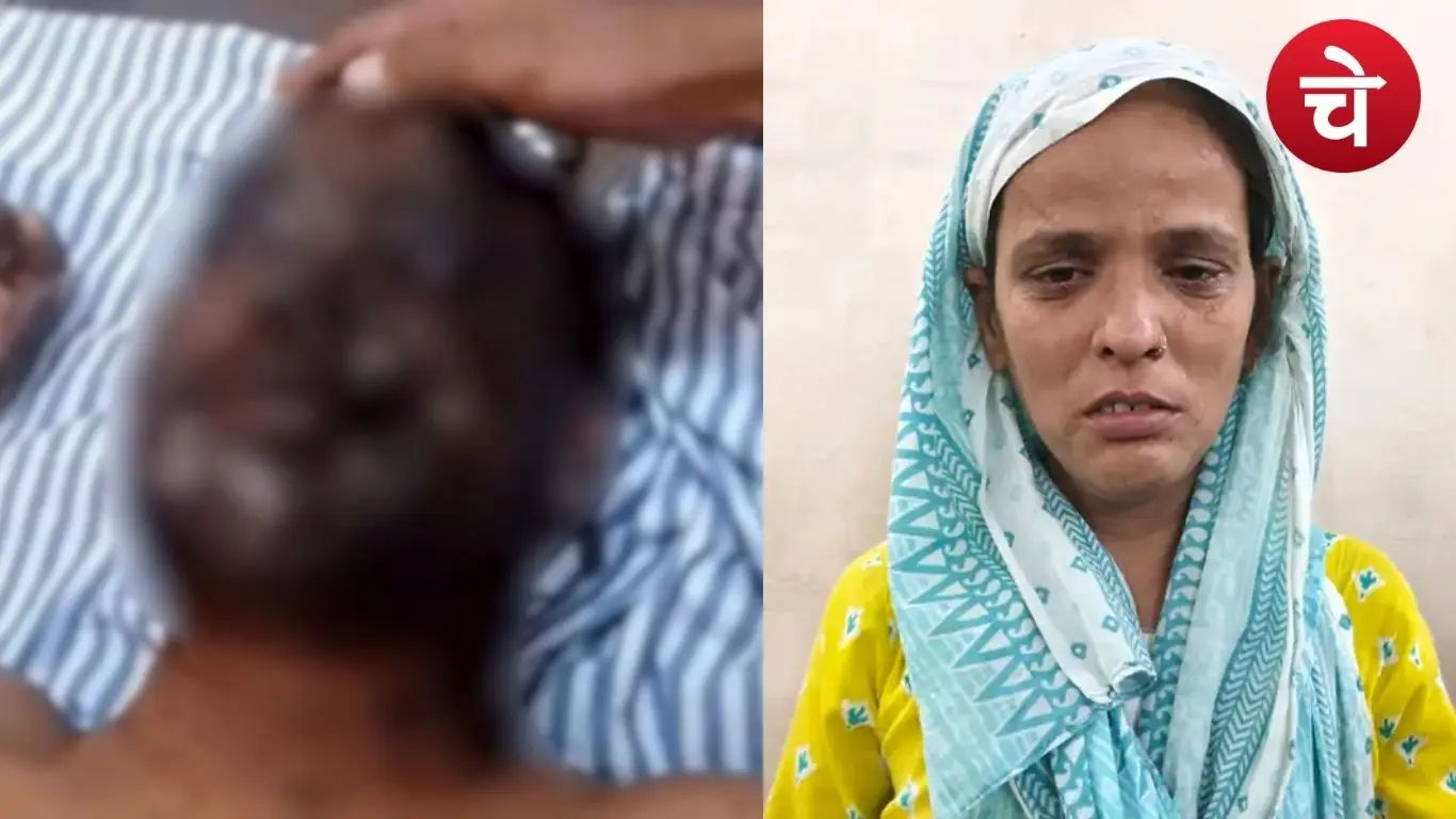 Sambhal Acid Attack Case