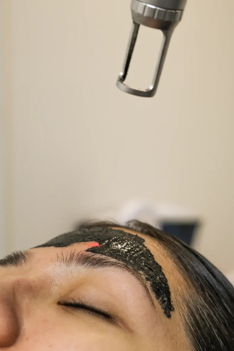 tratamiento hollywood glow en monterrey