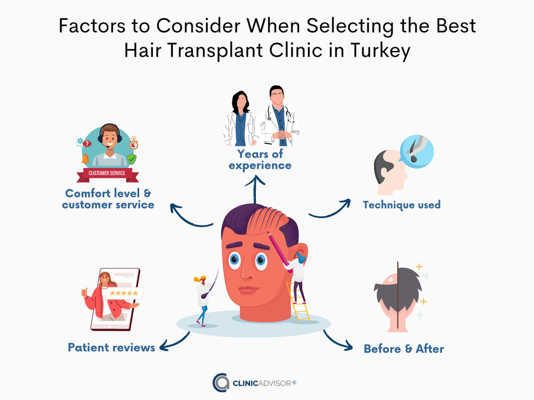 Factors to consider when selecting hair transplant clinic in Turkiye