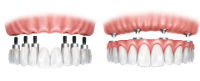 Clinics & Doctors Clidenta Dental Clinic in  İstanbul