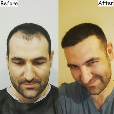 Amzing Before After results - 2021