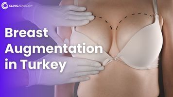 Breast Augmentation in Turkey: Safe, Affordable and Expert Surgeons