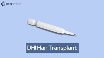 DHI Hair Transplant