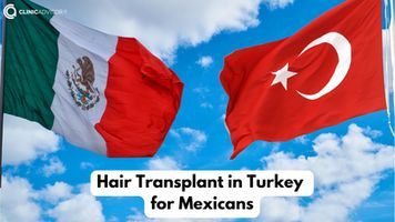 Hair Transplant in Turkey for Mexicans