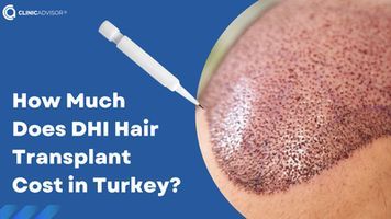 How Much Does a DHI Hair Transplant Cost in Turkey?