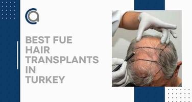 5 Best FUE Hair Transplants in Turkey