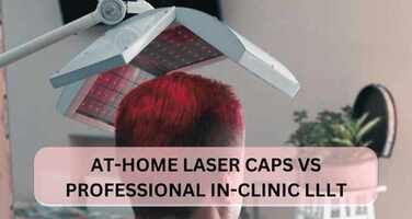 Comparing At-Home Laser Caps to Professional In-Clinic Low-Level Laser Treatments: Pros and Cons