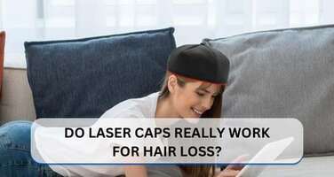 Do Laser Caps Really Work for Hair Loss?