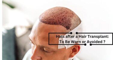 Hats After a Hair Transplant: Encouraged or Not?