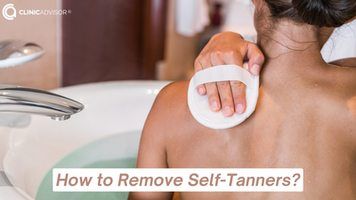 How to Remove Self-Tanner?