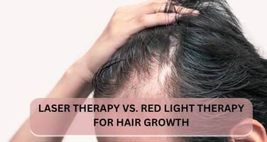 Laser Therapy vs. Red Light Therapy for Hair Growth: A Comprehensive Comparison