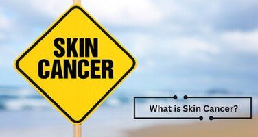 What is Skin Cancer?