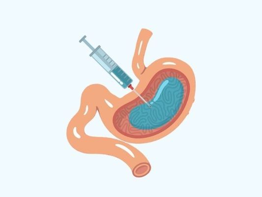 What is Stomach Botox in Turkey and How Effective it is in Weight Loss?