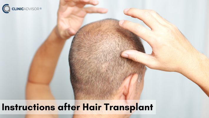 Tips and Instructions after Hair Transplant