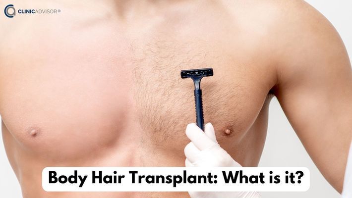 Body Hair Transplant