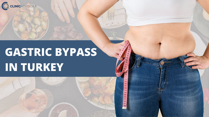 Gastric Bypass Surgery in Turkey: Safe, Effective and Affordable Weight Loss Solutions