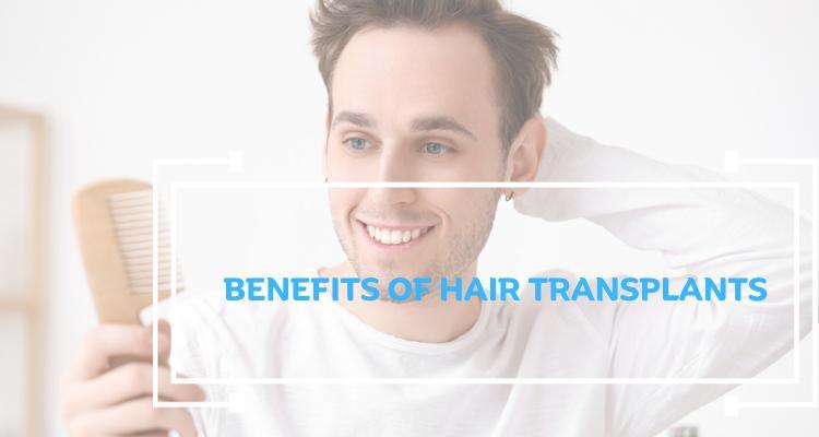 17 Benefits of Hair Transplant: Aesthetic, Psychological, and Long-Term Advantages