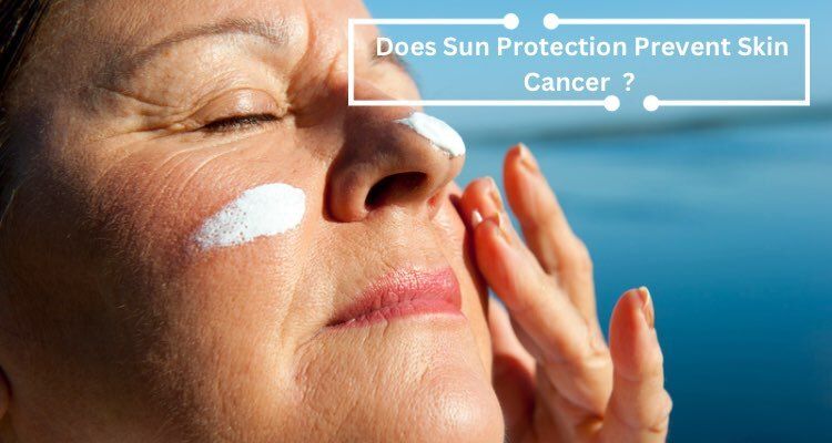 Does Sun Protection Prevent Skin Cancer?