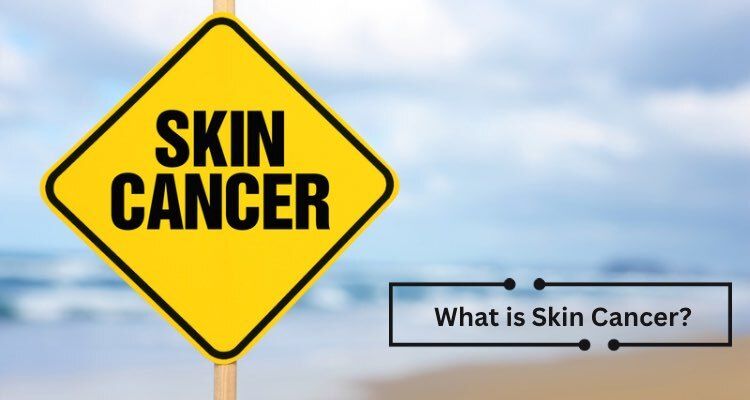 What is Skin Cancer?