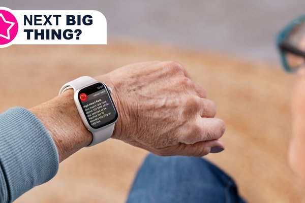  Your next Apple Watch could have this massive AI health upgrade  and no new sensors are needed 