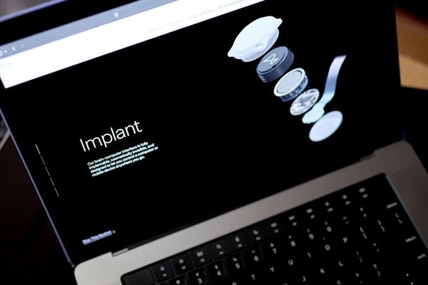 Neuralinks Groundbreaking Leap: Monkeys See the Invisible