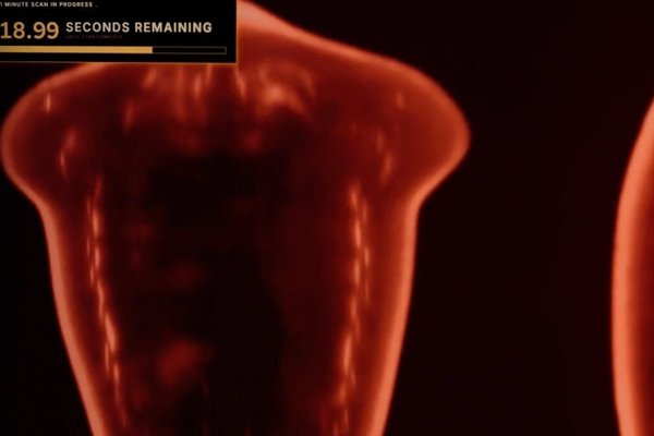 Remember Midjourney? Its Building a Medical Scanning Device That It Says Is Faster Than an MRI