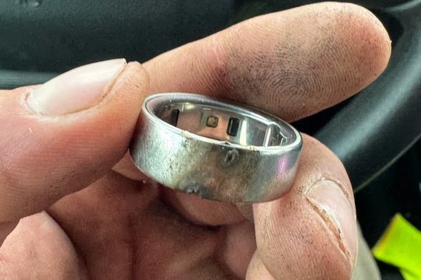 Oura users report smoking, overheating rings - what we know