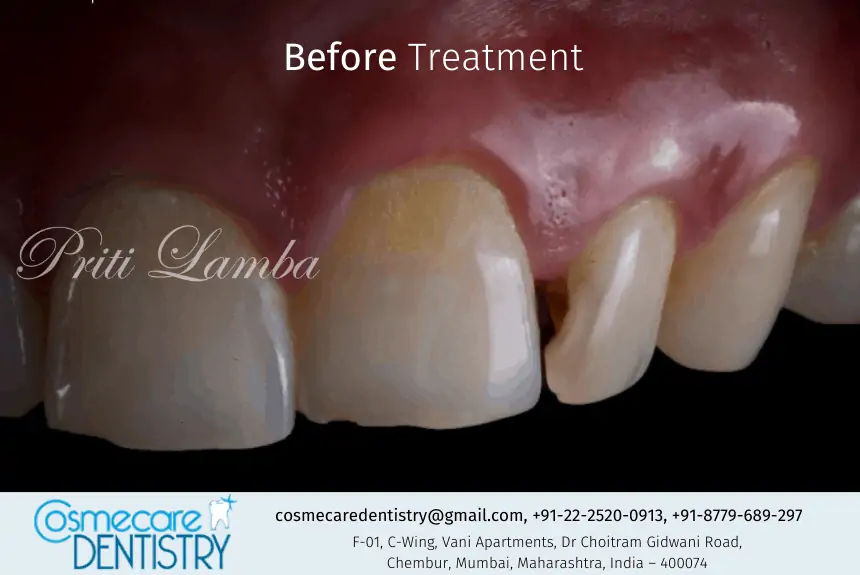 Smile Gallery Worldclass Top Dental Treatment in Chembur, Mumbai