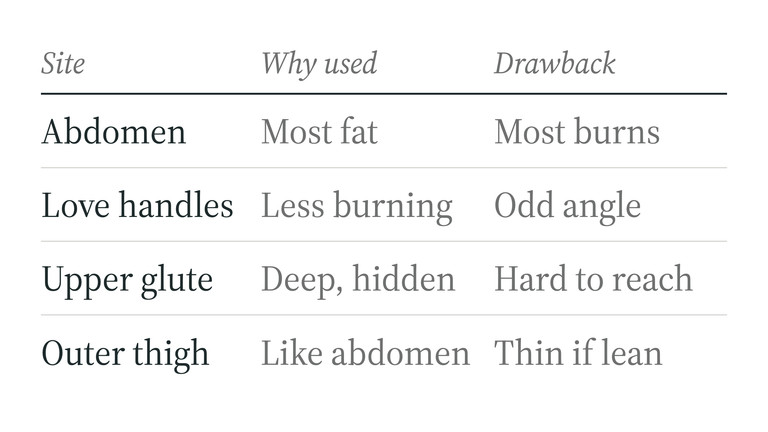 GHK-Cu injection sites compared: abdomen, love handles, upper glute, and outer thigh with the drawback of each