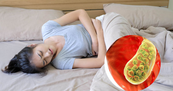 10 bước hướng dẫn dinh dưỡng vượt trội cho người mắc sỏi túi mật