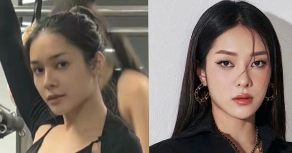 Á hậu Hồng Hạnh: Bí quyết nhan sắc sau phẫu thuật thẩm mỹ