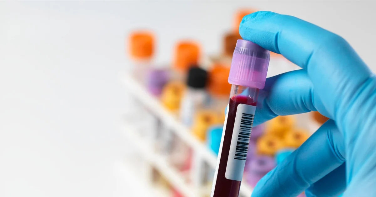 Blood Cleanup Services in Sumter, SC
