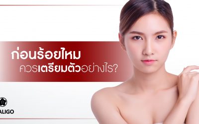 ก่อนร้อยไหมควรเตรียมตัวอย่างไร?