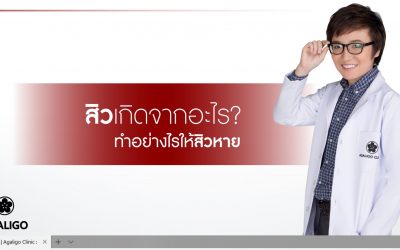 สิวเกิดจากอะไร? ทำอย่างไรให้สิวหาย?