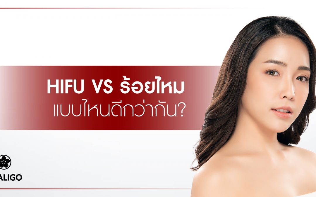 HIFU vs ร้อยไหม แบบไหนดีกว่ากัน?