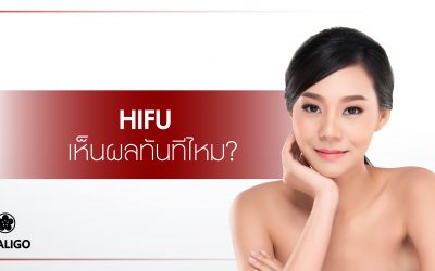 HIFU เห็นผลทันทีไหม?