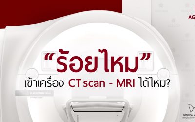 ร้อยไหมเข้าเครื่อง CT MRI ได้ไหม