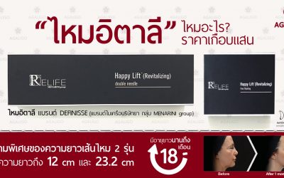 ไหมอิตาลี คืออะไร