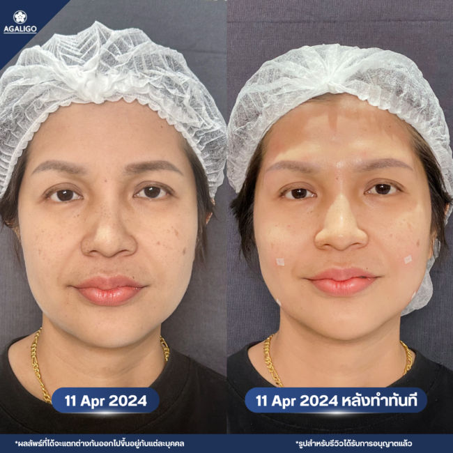 คุณนิ่มBเมกา+ไหม+ขมับ