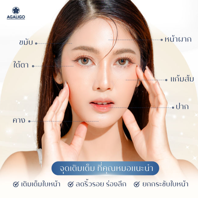 10จุด ฉีดฟิลเลอร์