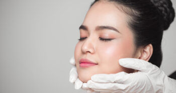 thread lift ร้อยไหมมินท์